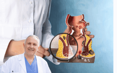 Emorroidi, come prevenire la malattia